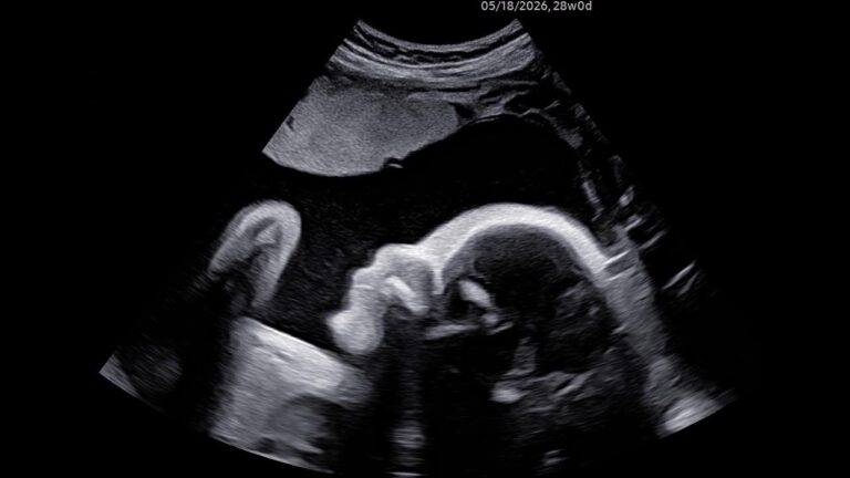Jenni and our beautiful 28 week baby's ultrasound—FIRE's real gift was an answer to infertility.