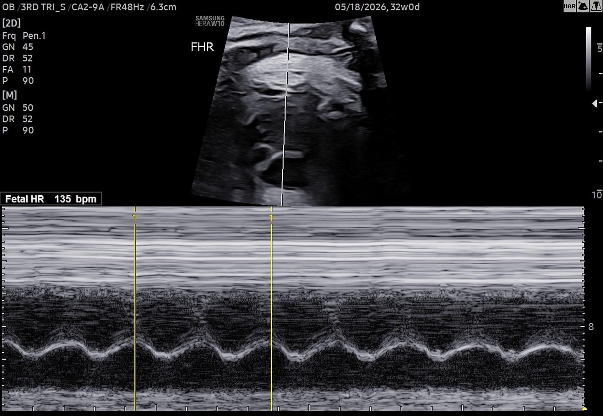 ...And baby continues to well with each new ultrasound and appointment!